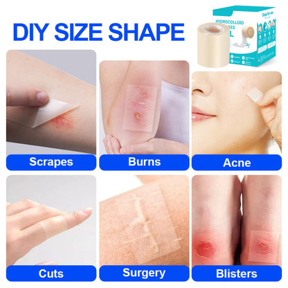 Zintlo™ Hydrocolloid Patch Roll – Cut-to-Size Acne & Blemish Care