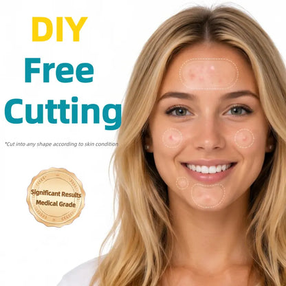 Zintlo™ Hydrocolloid Patch Roll – Cut-to-Size Acne & Blemish Care